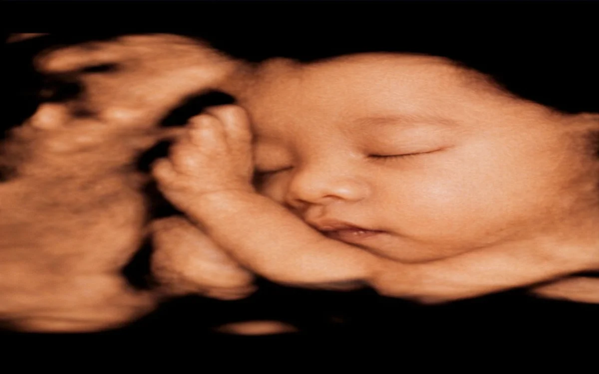 Ảnh thai nhi dựng bằng AI từ công cụ LovelyBaby — gợi ý trải nghiệm tạo ảnh 4D